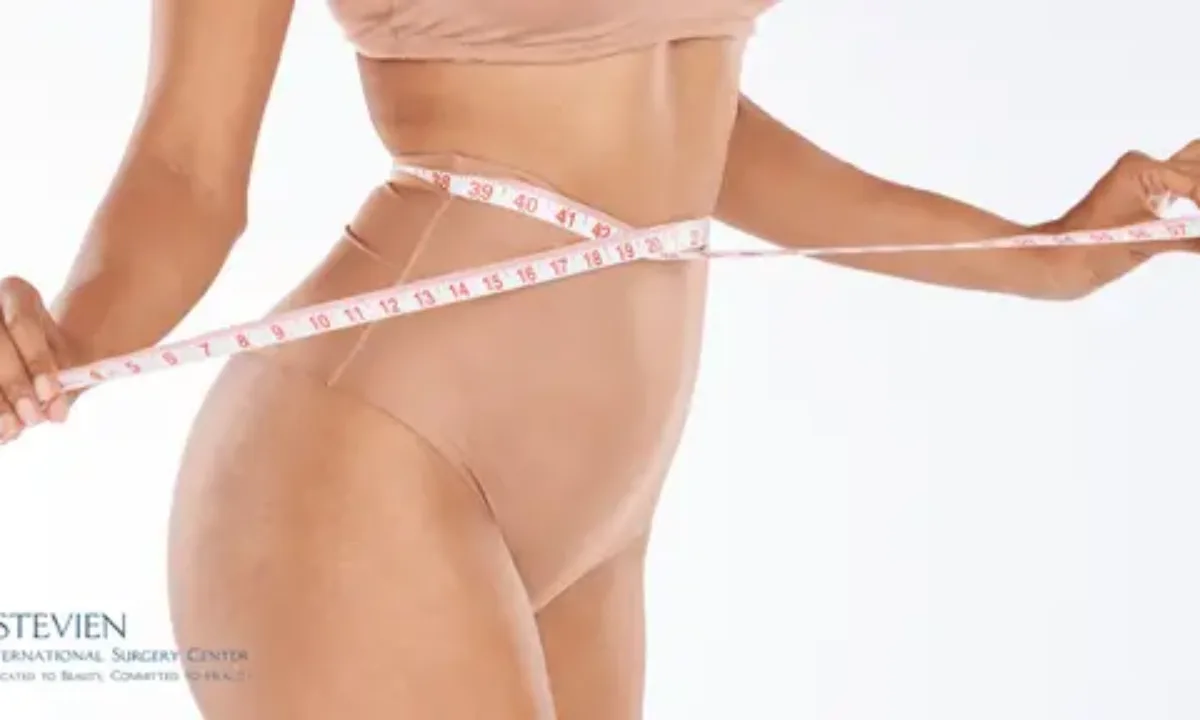 Plus Size Lipo 360: Everything You Need to Know 2024 - International Clinics