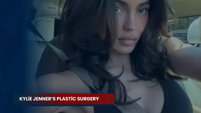 Kylie Jenner’s Plastic Surgery