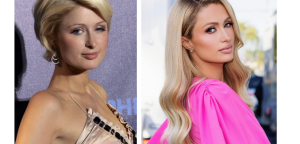 Paris Hilton Before and After Plastic Surgery Journey