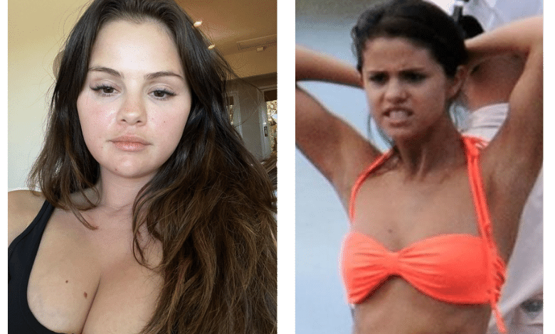 Selena Gomez Breast Augmentation Rumors Fact or Fiction