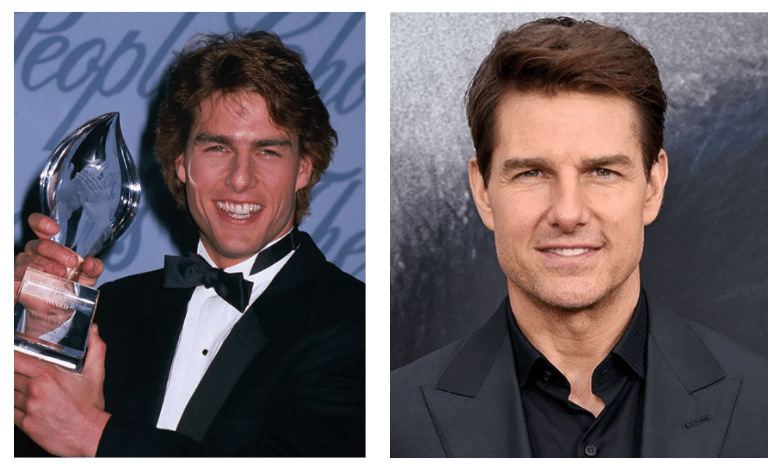 Tom Cruise and Rhinoplasty Rumors: Fact or Fiction? 