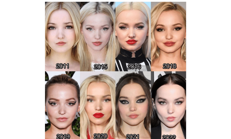 Get a Look Like Dove Cameron with Cosmetic Enhancements at Estevien Clinic 