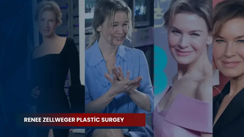 Renee Zellweger Plastic Surgey