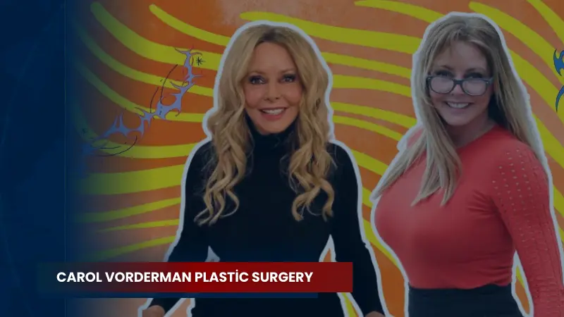 Carol Vorderman Plastic Surgery