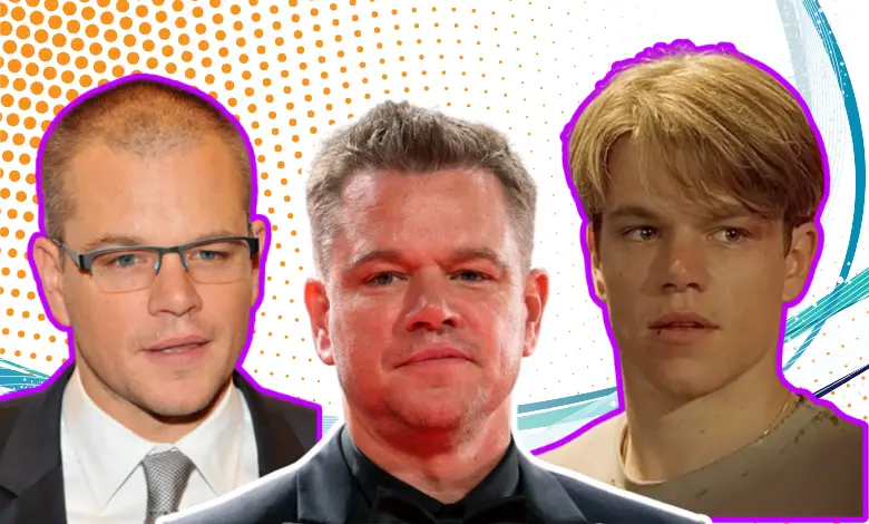 Matt Damon Hair Transplant