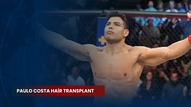 Paulo Costa Hair Transplant