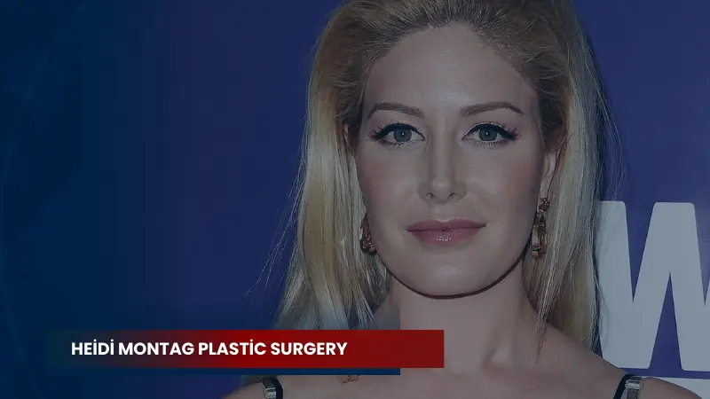 Heidi Montag Plastic Surgery