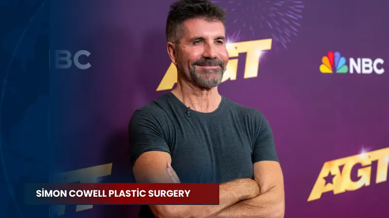 Simon Cowell Plastic Surgery
